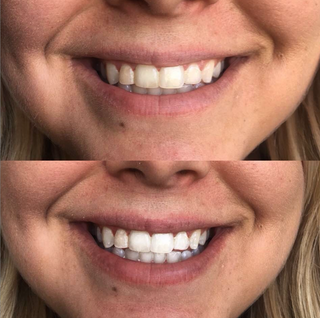 cozy smile kit, beaut.beautyco. - A Blissfully Beautiful Boutique